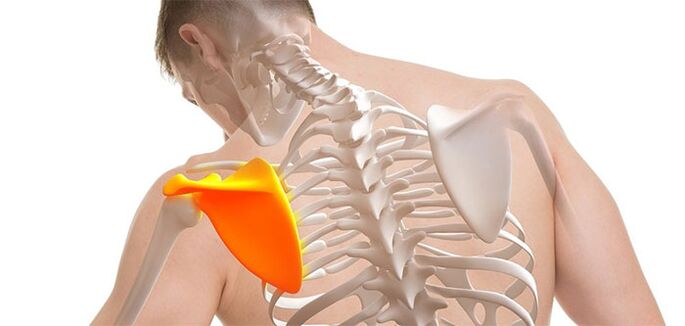 Back pain in the area of ​​the shoulder blade