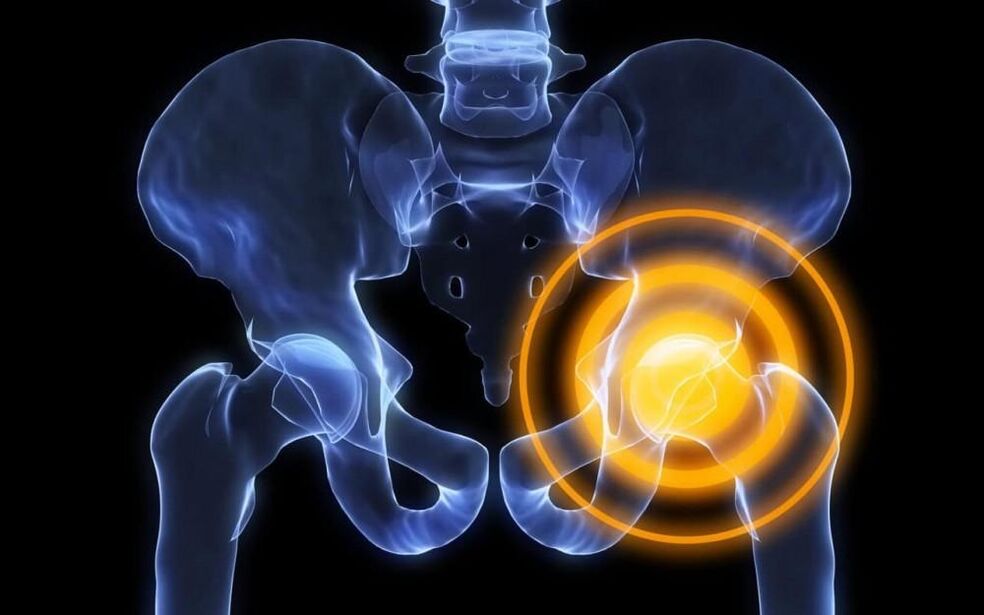 Hip joint pain picture 2