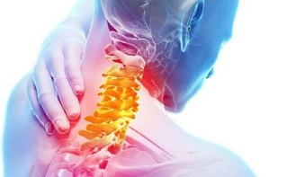 Symptoms of osteochondrosis of the cervical spine