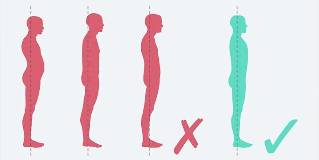 Posture problems and correct posture
